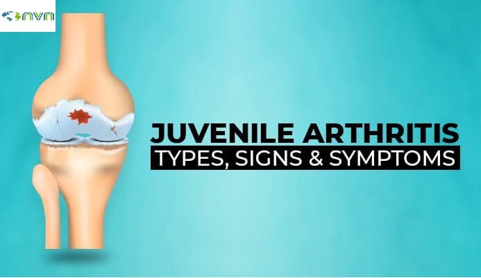 Juvenile Arthritis