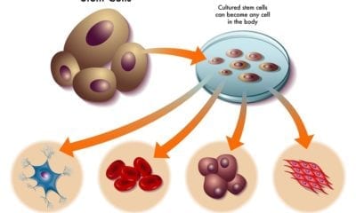 Stem cell