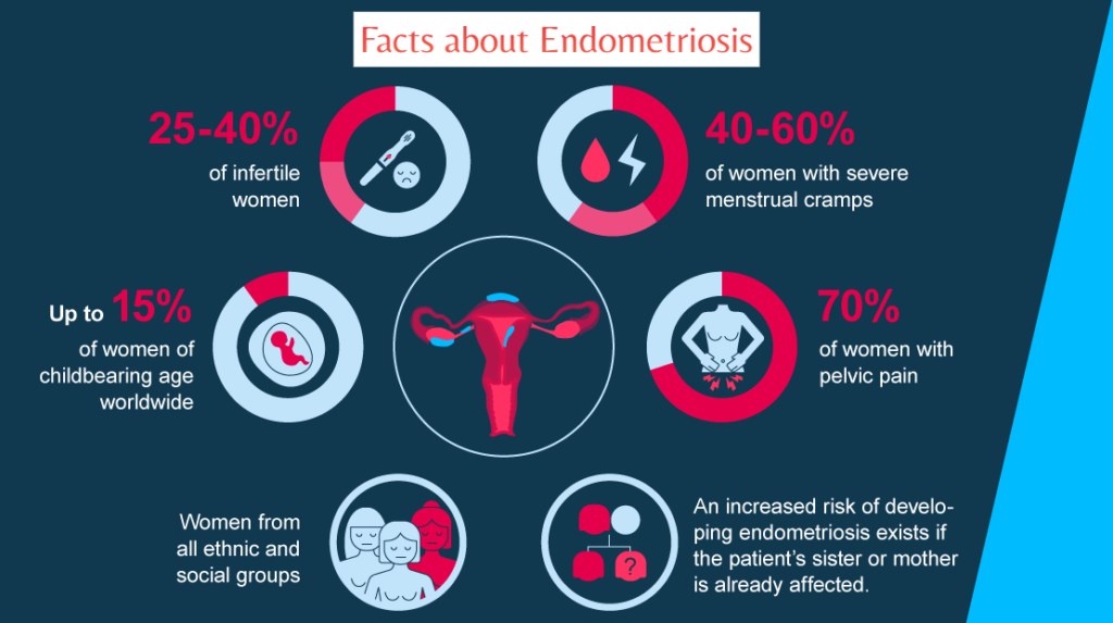 Endometriosis Leading Cause of Infertility in Women due to Delayed ...